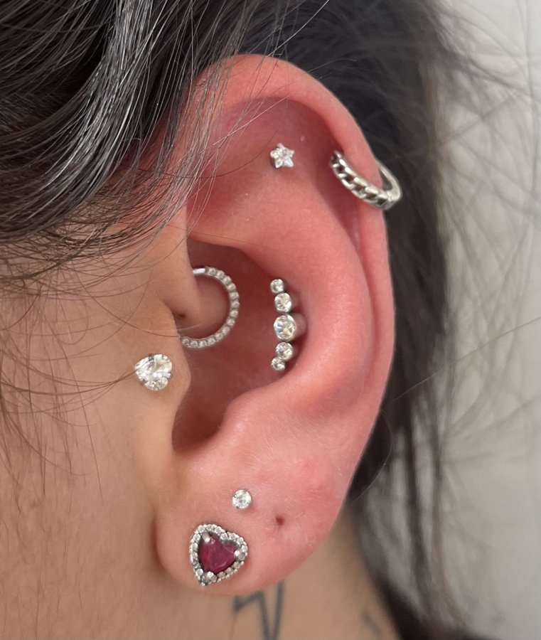 Minions/ upper lobe
